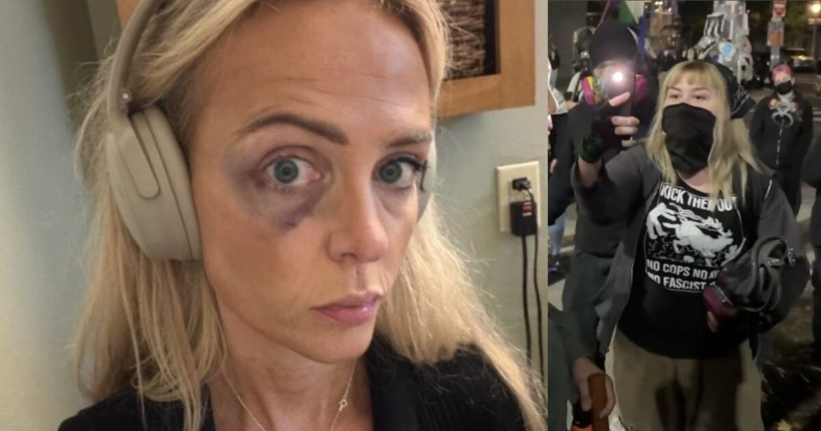 Portland Police Bureau Blames Conservative Journalist for Being Attacked by Antifa, Claims She ‘Instigated’ by Simply Being There