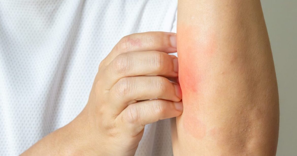 A Promising New Treatment for the 84 Million Americans Suffering from Skin Conditions A Promising New Treatment for the 84 Million Americans Suffering from Skin Conditions