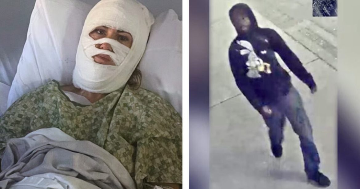 HORROR: Georgia Woman Suffers Severe Burns to Her Face, Neck and Scalp After Stranger Douses Her with Acid at Park – Suspect at Large