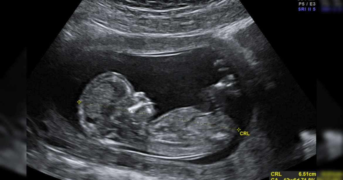 Dads Are Using Mail-order Mifepristone to Kill Their Unwanted Babies