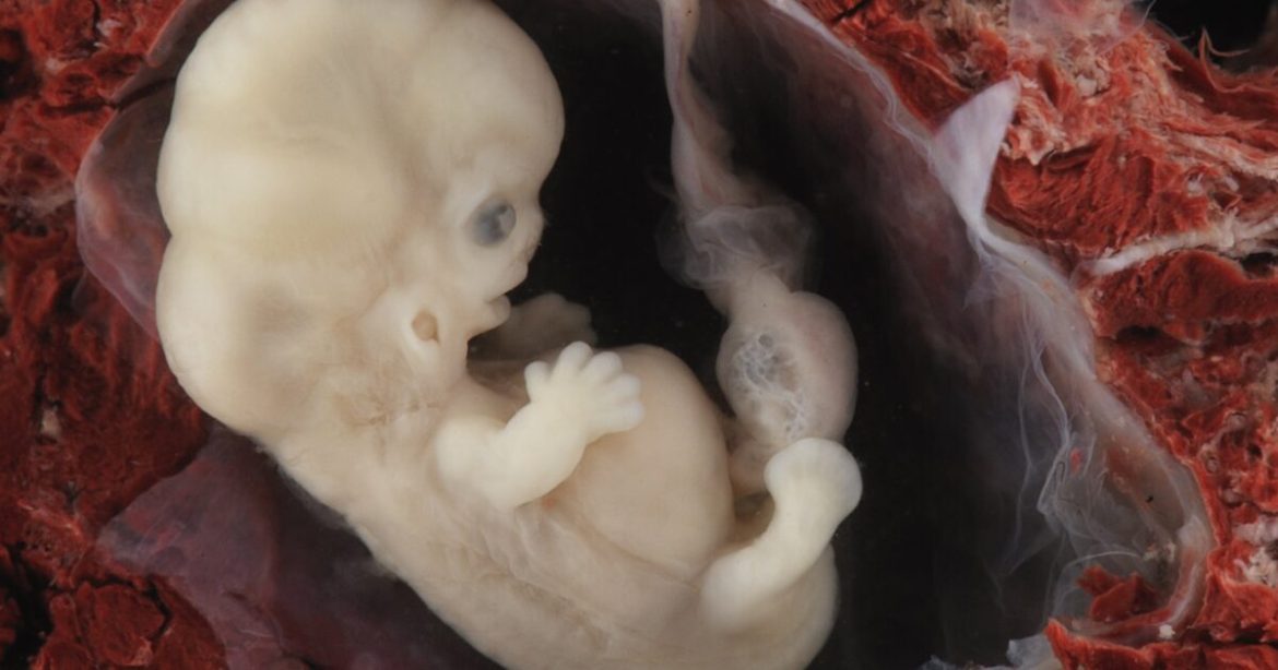 Abortion: “It’s Just a Clump of Cells” That Happens to Be a Baby