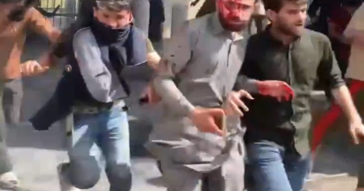FAFO: Bloody Scene Unfolds as Security Forces Fire on Armed Militants as They Try to Storm US Consulate in Pakistan (VIDEO)